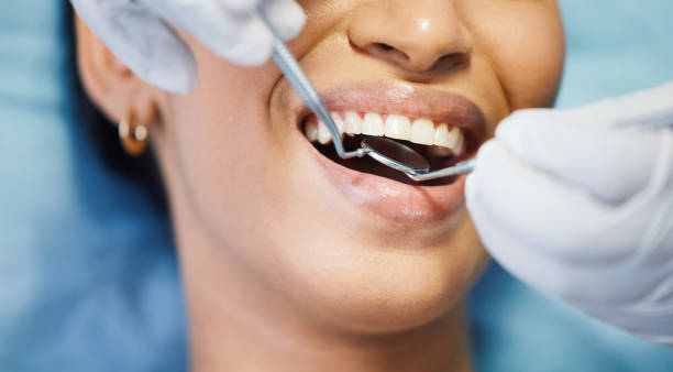 Best Mobile Emergency Dentist in Allyn, WA
