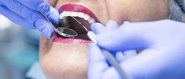 Best Emergency Dental Extractions in Allyn, WA